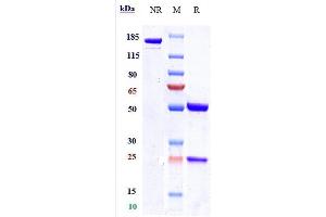 Anti-Nectin-4 Reference Antibody (enfortumab) on SDS-PAGE under reducing (R) condition. (Recombinant Nectin-4 (Enfortumab Biosimilar) 抗体)