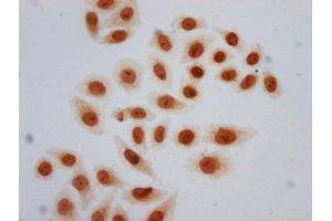 Immunocytochemistry analysis of ABIN7139157 diluted at 1:5 and staining in Hela cells (treated with 30mM sodium butyrate for 4h) performed on a Leica BondTM system. (HIST1H2AG 抗体  (acLys13))