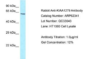 Western Blotting (WB) image for anti-KIAA1279 (KIAA1279) (C-Term) antibody (ABIN2774341) (KIF1BP 抗体  (C-Term))