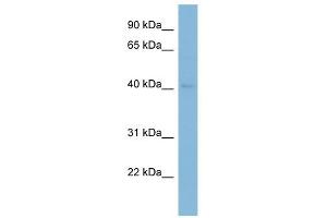 RAB3IL1 antibody used at 1 ug/ml to detect target protein. (RAB3IL1 抗体)