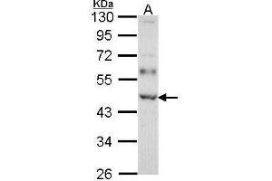 WB Image Sample (30 ug of whole cell lysate) A: Molt-4 , 10% SDS PAGE WTAP antibody antibody diluted at 1:1000