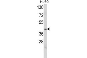 Western Blotting (WB) image for anti-Apolipoprotein L, 4 (APOL4) antibody (ABIN3002795) (Apolipoprotein L 4 抗体)