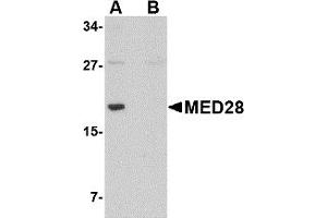 Western Blotting (WB) image for anti-Mediator Complex Subunit 28 (MED28) (Middle Region) antibody (ABIN1031001) (MED28 抗体  (Middle Region))