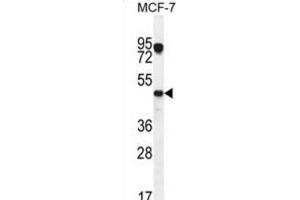 Western Blotting (WB) image for anti-Vascular Endothelial Growth Factor C (VEGFC) antibody (ABIN2996454) (VEGFC 抗体)