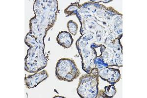 Immunohistochemistry of paraffin-embedded human placenta using CD46 Rabbit pAb (ABIN3022325, ABIN3022326, ABIN1512715, ABIN1513898 and ABIN6218741) at dilution of 1:100 (40x lens). (CD46 抗体  (AA 40-320))