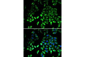 Immunofluorescence analysis of U2OS cells using PKM2 antibody . (PKM 抗体  (AA 11-221))