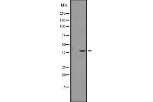Western blot analysis of OPRL1 expression in A431 whole cell lysate ,The lane on the left is treated with the antigen-specific peptide. (OPRL1 抗体  (C-Term))
