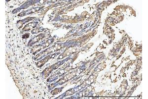 IHC analysis of CA1 using anti-CA1 antibody (ABIN3043766).