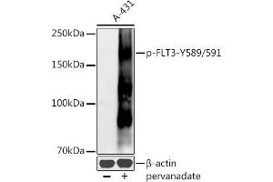 Western blot analysis of extracts of A-431 cells, using Phospho-FLT3-Y589/591 antibody (ABIN6135223, ABIN6136082, ABIN6136083 and ABIN6225559) at 1:500 dilution. (FLT3 抗体  (pTyr589, pTyr591))