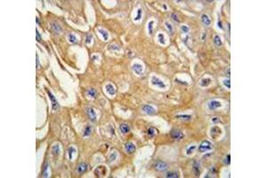 Immunohistochemistry (Paraffin-embedded Sections) (IHC (p)) image for anti-Receptor-Interacting serine-threonine Kinase 3 (RIPK3) (Middle Region) antibody (ABIN359363)