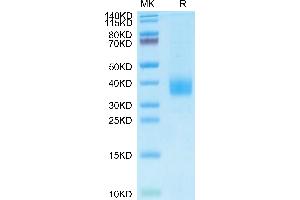 Cynomolgus Siglec-15 on Tris-Bis PAGE under reduced condition. (SIGLEC15 Protein (AA 60-322) (His-Avi Tag))