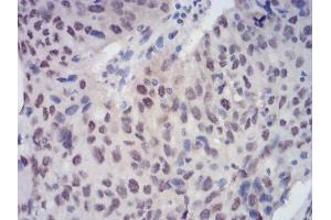 Immunohistochemistry (IHC) image for anti-Chromobox Homolog 3 (CBX3) (AA 1-183) antibody (ABIN5542474)
