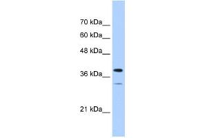 WB Suggested Anti-PGAM2 Antibody Titration:  0. (PGAM2 抗体  (N-Term))