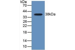 Western blot analysis of recombinant Human MDC. (CCL22 抗体  (AA 25-93))