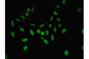 Immunofluorescent analysis of Hela cells using ABIN7144263 at dilution of 1:100 and Alexa Fluor 488-congugated AffiniPure Goat Anti-Rabbit IgG(H+L) (Annexin A11 抗体  (AA 276-505))
