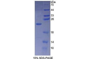 SDS-PAGE (SDS) image for phospholipase C, beta 1 (phosphoinositide-Specific) (PLCB1) (AA 316-476) protein (His tag) (ABIN6238764) (Phospholipase C beta 1 Protein (AA 316-476) (His tag))