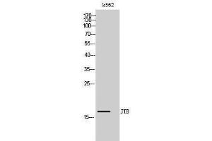 Western Blotting (WB) image for anti-Jumping Translocation Breakpoint (JTB) (N-Term) antibody (ABIN3175743) (JTB 抗体  (N-Term))