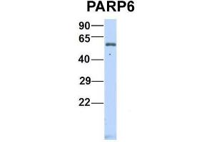 Host:  Rabbit  Target Name:  P Sample Type:  Human Fetal Heart  Antibody Dilution:  1. (PARP6 抗体  (N-Term))