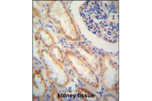 SHISA2 antibody immunohistochemistry analysis in formalin fixed and paraffin embedded human kidney tissue followed by peroxidase conjugation of the secondary antibody and DAB staining. (SHISA2 抗体  (C-Term))