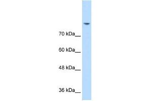 DLG2 antibody used at 0. (DLG2 抗体)