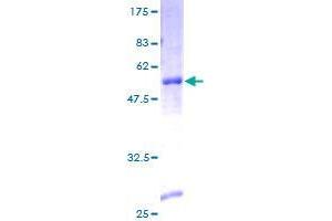 Image no. 1 for Stathmin-Like 4 (STMN4) (AA 1-216) protein (GST tag) (ABIN1321724) (STMN4 Protein (AA 1-216) (GST tag))