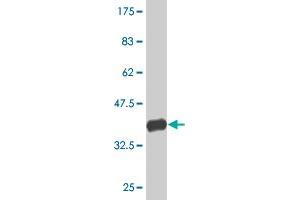 Western Blot detection against Immunogen (37. (EP400 抗体  (AA 743-850))