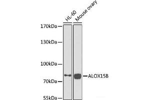 Western blot analysis of extracts of various cell lines using ALOX15B Polyclonal Antibody at dilution of 1:1000. (ALOX15B 抗体)