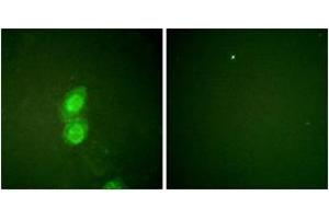 Immunofluorescence analysis of HuvEc cells, using Catenin-delta1 (Phospho-Tyr228) Antibody. (CTNND1 抗体  (pTyr228))
