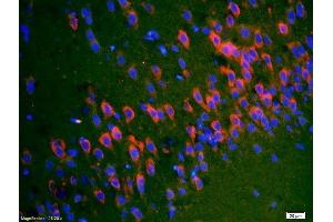 Formalin-fixed and paraffin-embedded rat brain labeled with Anti-SYTL5/slp5 Polyclonal Antibody, Unconjugated (ABIN754498) 1:200, overnight at 4°C, The secondary antibody was Goat Anti-Rabbit IgG, Cy3 conjugated used at 1:200 dilution for 40 minutes at 37°C. (SYTL5 抗体  (AA 801-921))