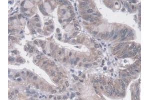 Immunohistochemistry (IHC) image for anti-Protein Tyrosine Phosphatase Receptor Type F (PTPRF) (AA 30-224) antibody (ABIN7444742)