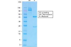SDS-PAGE Analysis Purified PTH Rabbit Recombinant Monoclonal Antibody (PTH/1717R). (Recombinant PTH 抗体  (AA 1-34))