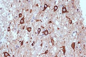 Immunohistochemistry of paraffin-embedded human brain using PRKRA/PACTRabbit mAb (ABIN7269666) at dilution of 1:100 (40x lens). (PRKRA 抗体)