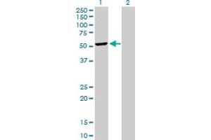 Western Blot analysis of DCTN2 expression in transfected 293T cell line by DCTN2 MaxPab polyclonal antibody. (Dynamitin 抗体  (AA 1-401))