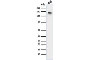 Western Blot Analysis of Raji cell lysate using CD22-Monospecific Mouse Monoclonal Antibody (BLCAM/1795). (CD22 抗体  (AA 52-178))