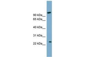 Image no. 1 for anti-ADP-Ribosylation Factor-Like 8A (ARL8A) (AA 71-120) antibody (ABIN6744124) (ARL8A 抗体  (AA 71-120))