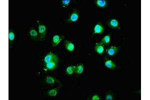 Immunofluorescence staining of A549 cells with ABIN7165570 at 1:133, counter-stained with DAPI. (FAM83G 抗体  (AA 464-615))
