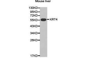 Western Blotting (WB) image for anti-Keratin 4 (KRT4) antibody (ABIN1873488) (KRT4 抗体)