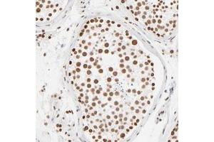 Immunohistochemical staining of human testis with ZNF540 polyclonal antibody  shows strong nuclear positivity in cells of seminiferus ducts. (ZNF540 抗体)