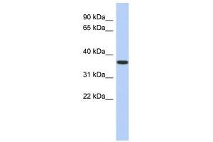 MVK antibody used at 1 ug/ml to detect target protein. (MVK 抗体  (N-Term))