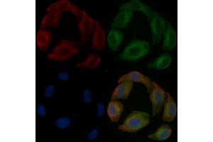TBC1D21 Mouse Monoclonal Antibody staining Hela cells by IF/ICC. (TBC1D21 抗体)