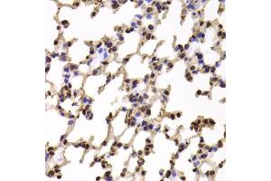 Immunohistochemistry of paraffin-embedded Mouse lung using KIF2B antibody at dilution of 1:100 (x400 lens). (KIF2B 抗体)