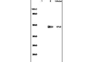 Formalin-fixed and paraffin embedded human colon carcinoma labeled with Anti VIP Receptor 1/VAPC1 Polyclonal Antibody, Unconjugated (ABIN872880) at 1:200 followed by conjugation to the secondary antibody and DAB staining (VIPR1 抗体  (AA 351-457))
