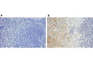 Staining of endogenous human Periostin in human breast cancer tissues (paraffin sections) by using Periostin, mAb (Stiny-1) . (Periostin 抗体  (full length))