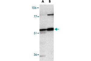 Western blot analysis of Casp12 in human (A) and mouse (B) spleen tissue lysates with Casp12 polyclonal antibody  at 1 ug/mL . (Caspase 12 抗体  (AA 2-17))