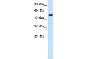 WB Suggested Anti-SMAD6 Antibody Titration:  0. (SMAD6 抗体  (N-Term))