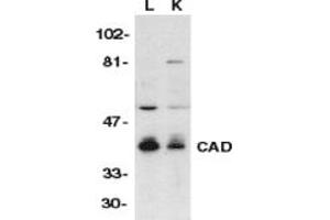 Image no. 1 for anti-DNA Fragmentation Factor, 40kDa, beta Polypeptide (Caspase-Activated DNase) (DFFB) (AA 314-329) antibody (ABIN201898) (DFFB 抗体  (AA 314-329))