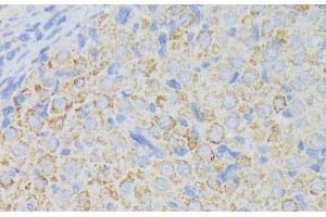 Immunohistochemistry of paraffin-embedded Rat ovary using ACADL Polyclonal Antibody at dilution of 1:100 (40x lens). (ACADL 抗体)