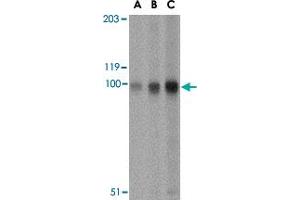 Western blot analysis of STIM2 in A-20 cell lysate with STIM2 polyclonal antibody  at (A) 0. (Stim2 抗体  (Internal Region))