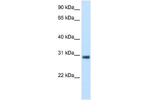 WB Suggested Anti-KCTD6 Antibody Titration:  5. (KCTD6 抗体  (N-Term))