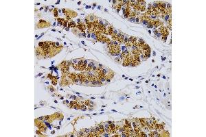 Immunohistochemistry (IHC) image for anti-Cyclin-Dependent Kinase 7 (CDK7) (AA 1-346) antibody (ABIN3022405)